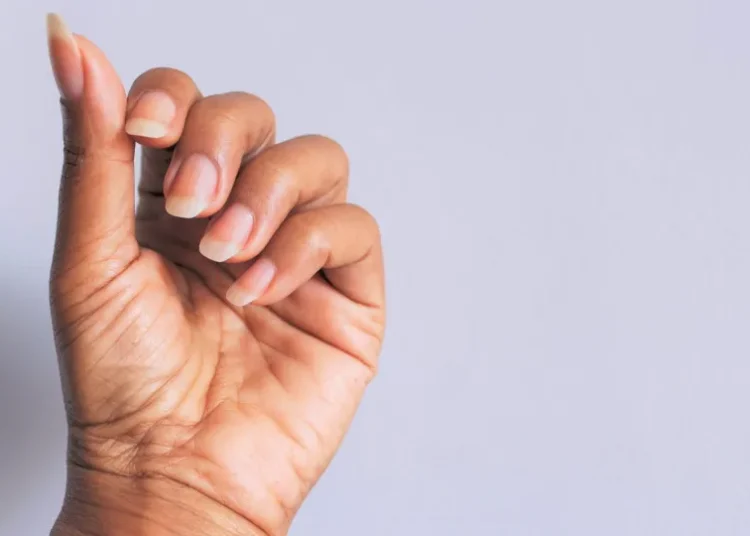 Dermatologista revela como ter unhas mais fortes e saudáveis