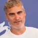 As histórias por trás das cicatrizes dos famosos