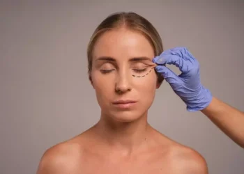 Blefaroplastia - CBS BRASIL