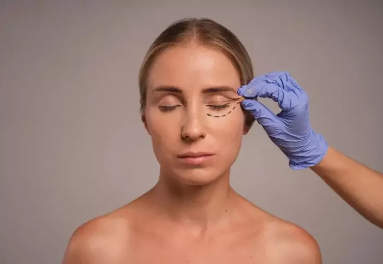 Blefaroplastia - CBS BRASIL