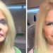 Monique Evans faz harmonização facial e resultado surpreendente